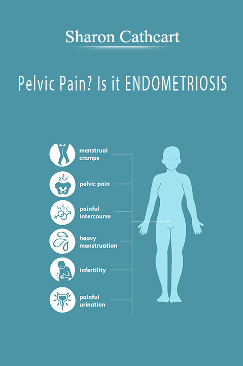 Pelvic Pain? Is it ENDOMETRIOSIS – Sharon Cathcart